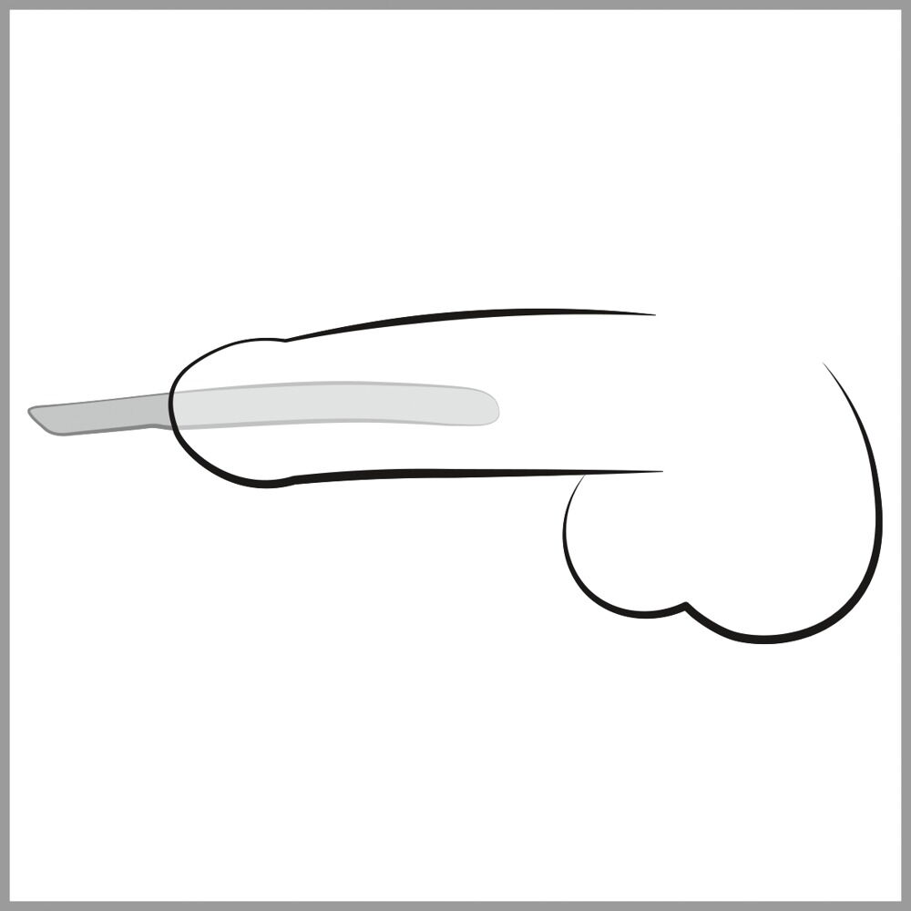 14-Piece Dilator Set