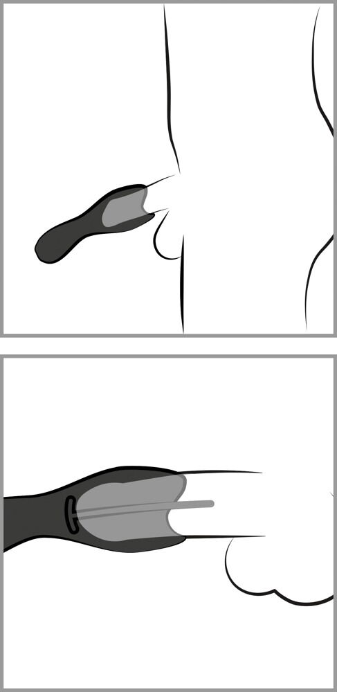 Glans Masturbator with 3 Dilators