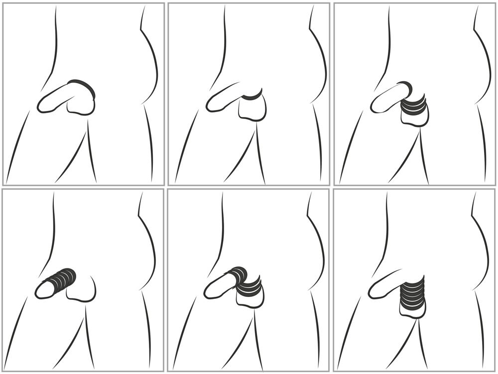 Cock & Ball Stretching Kit