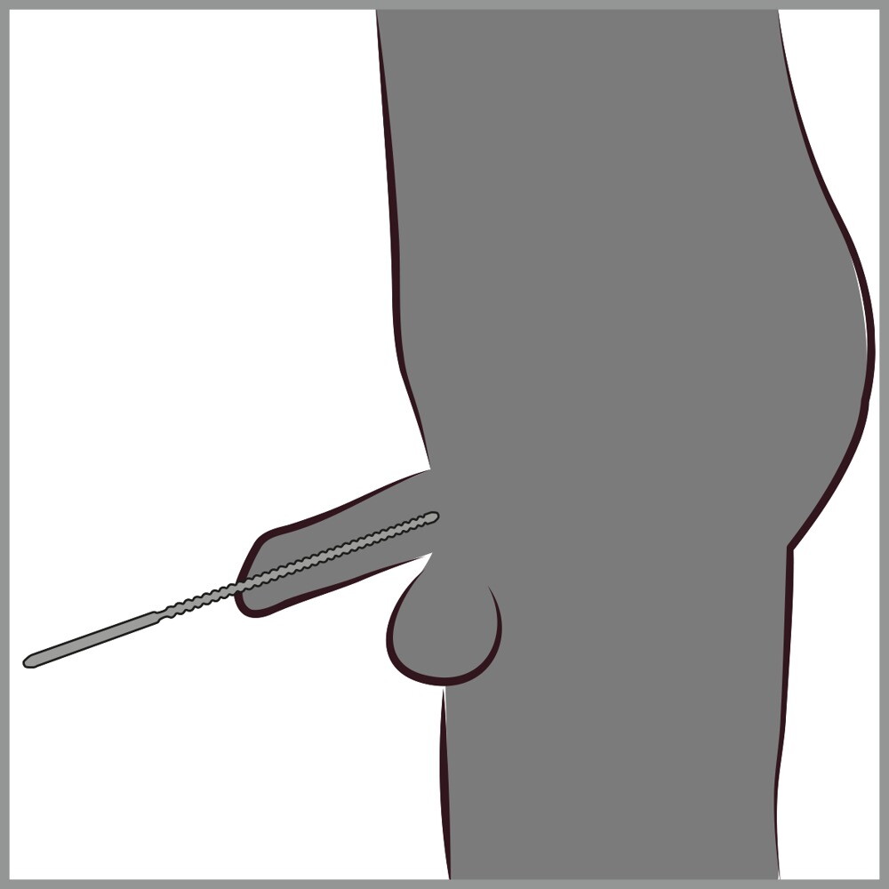 Ribbed Dilator
